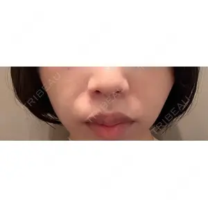 口コミ