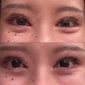 フィラークリニック フィラークリニック 新宿院口コミ