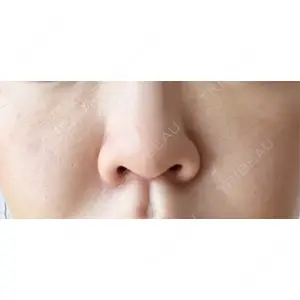 まゆりなclinic 名古屋栄口コミ