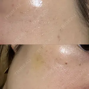 NEO Skin Clinic NEO Skin Clinic恵比寿口コミ