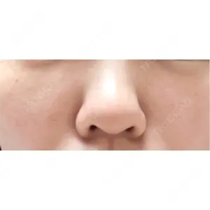 まゆりなclinic 名古屋栄口コミ