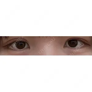 HAAB×DREAM BEAUTY CLINIC HAAB×DREAM BEAUTY CLINIC 東京本院口コミ