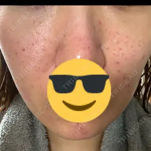 ゆきスキンクリニック 東池袋口コミ