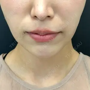 口コミ
