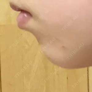 口コミ