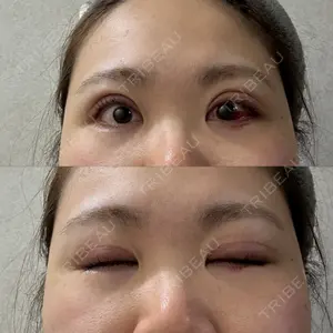 口コミ