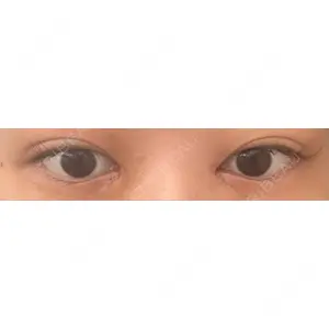 口コミ