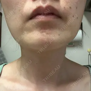 ルラ美容クリニック ルラ美容クリニック 広島院口コミ