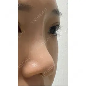 プライベートスキンクリニック 梅田本院口コミ