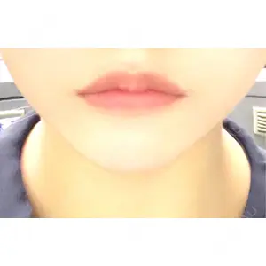 フィラークリニック フィラークリニック 大阪心斎橋院口コミ