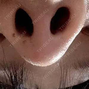 アネシス美容クリニック口コミ