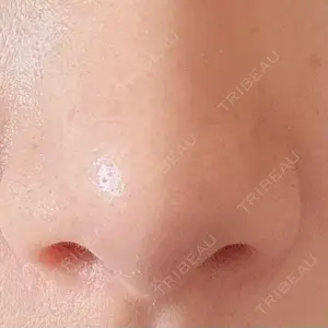 アネシス美容クリニック口コミ