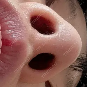 アネシス美容クリニック口コミ