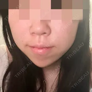 口コミ