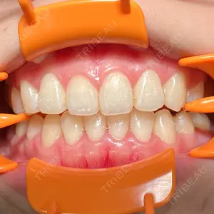 アンデルト歯科・矯正歯科口コミ