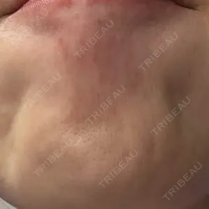 ルラ美容クリニック ルラ美容クリニック 広島院口コミ