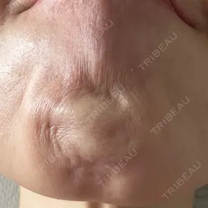 ルラ美容クリニック ルラ美容クリニック 広島院口コミ