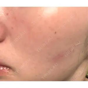 Natural Skin Clinic Natural Skin Clinic 笹塚院口コミ