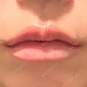口コミ