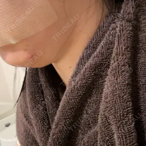 plume clinic plume clinic口コミ