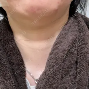 plume clinic plume clinic口コミ