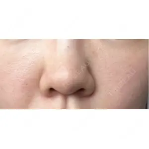 まゆりなclinic 名古屋栄口コミ