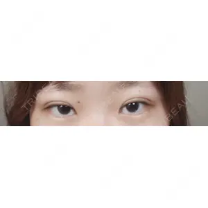 口コミ