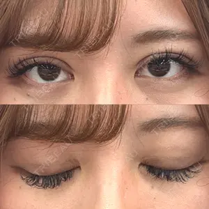 口コミ