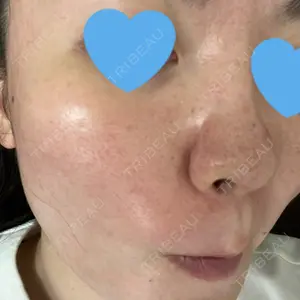 東京シルククリニック 東京シルククリニック 東京神田院口コミ