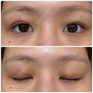 大塚美容形成外科 大塚美容形成外科 銀座本院口コミ