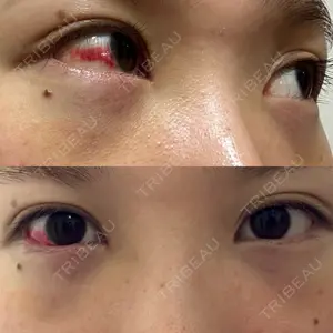 TCB東京中央美容外科 TCB東京中央美容外科 藤沢院口コミ