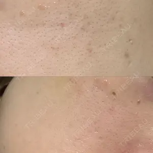 NEO Skin Clinic NEO Skin Clinic恵比寿口コミ