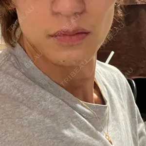 口コミ