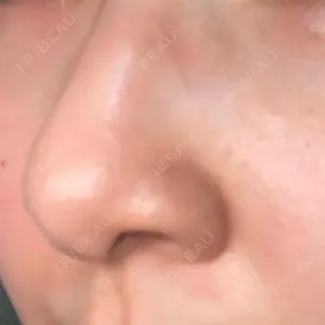 東京シルククリニック 東京シルククリニック 東京神田院口コミ