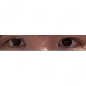 HAAB×DREAM BEAUTY CLINIC HAAB×DREAM BEAUTY CLINIC 東京本院口コミ