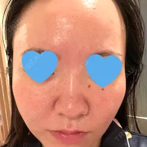 東京シルククリニック 東京シルククリニック 東京神田院口コミ