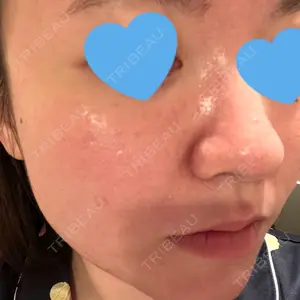 東京シルククリニック 東京シルククリニック 東京神田院口コミ