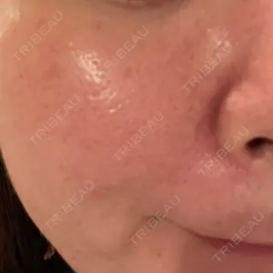 東京シルククリニック 東京シルククリニック 東京神田院口コミ