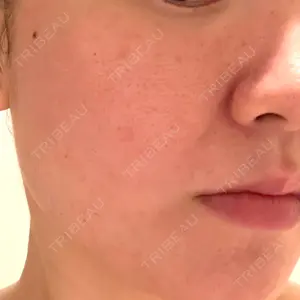 東京シルククリニック 東京シルククリニック 東京神田院口コミ