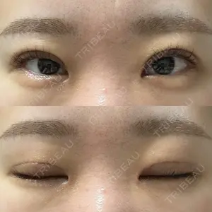 プロミス整形外科口コミ