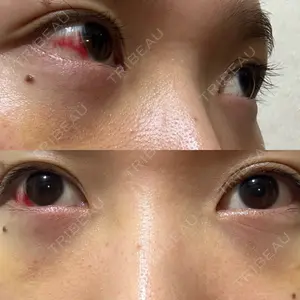 TCB東京中央美容外科 TCB東京中央美容外科 藤沢院口コミ