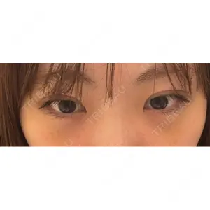 吉祥寺アイビークリニック口コミ