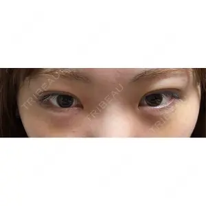 吉祥寺アイビークリニック口コミ
