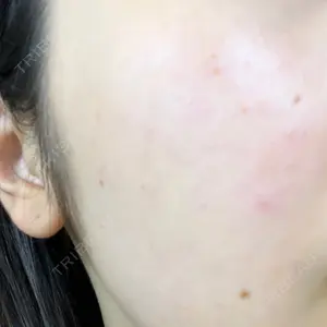 東京シルククリニック 東京シルククリニック 東京神田院口コミ