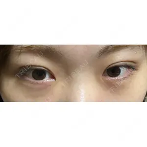吉祥寺アイビークリニック口コミ