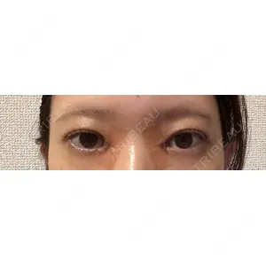 口コミ