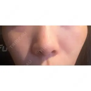 L‘amour clinic Tokyo【ラムールクリニック東京】口コミ