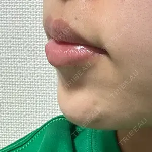 口コミ