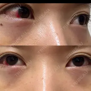 TCB東京中央美容外科 TCB東京中央美容外科 藤沢院口コミ