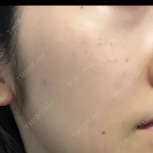 東京シルククリニック 東京シルククリニック 東京神田院口コミ